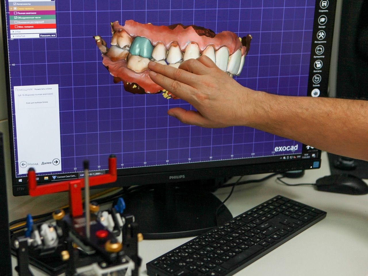 3D сканирование челюсти